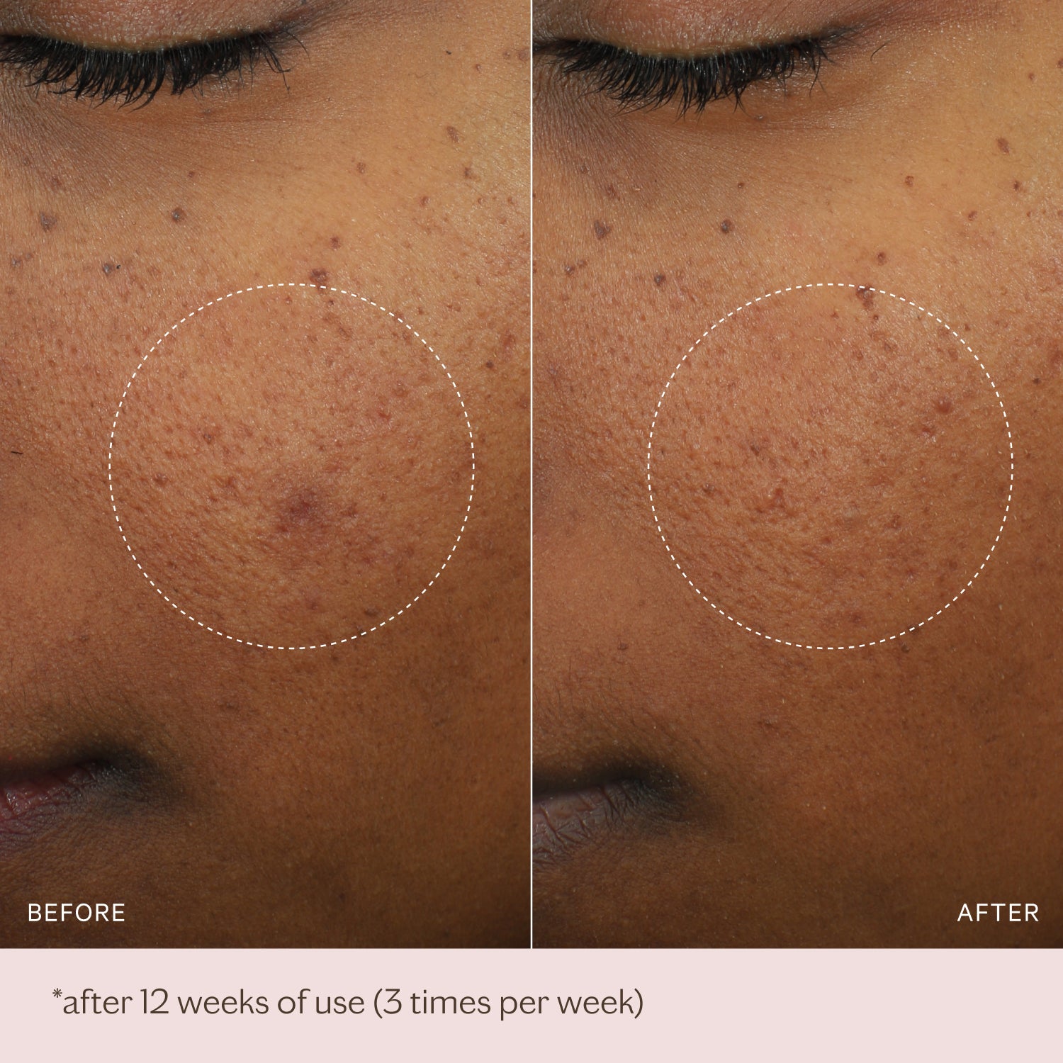 Micro-Peeling Glow Essence