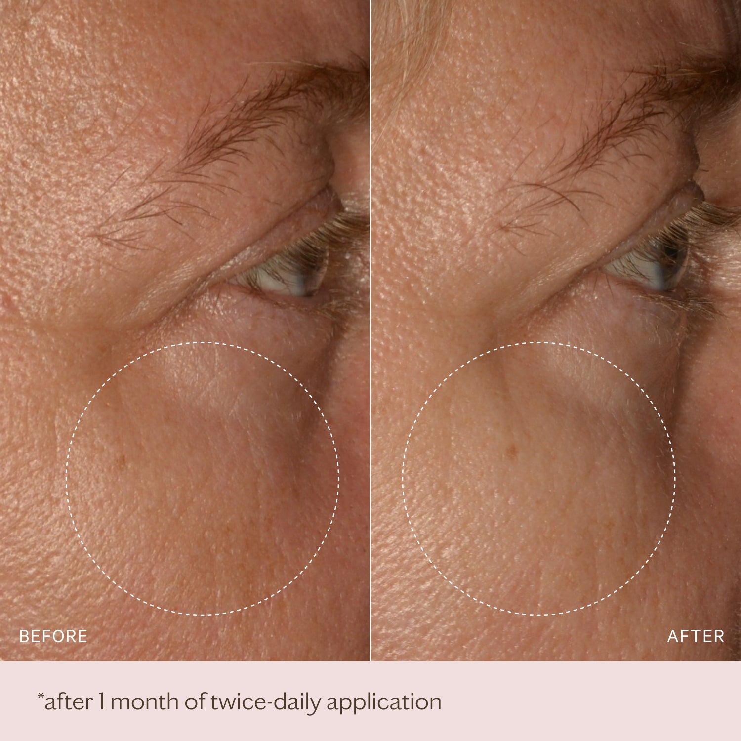 Hydrate & Nourish Hyaluronic & Retinol Day Moisturiser SPF30