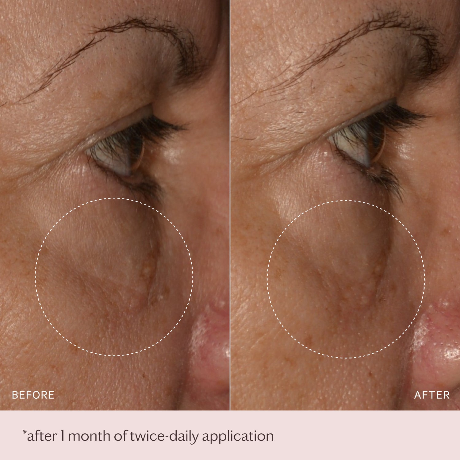 Mini Soothe & Smooth Hyaluronic Brightening Eye Complex