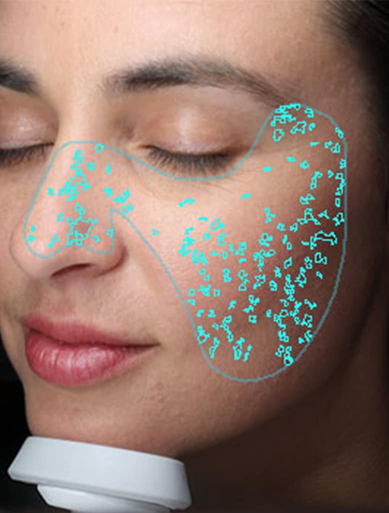 Skin Analysis with VISIA, you’re invited