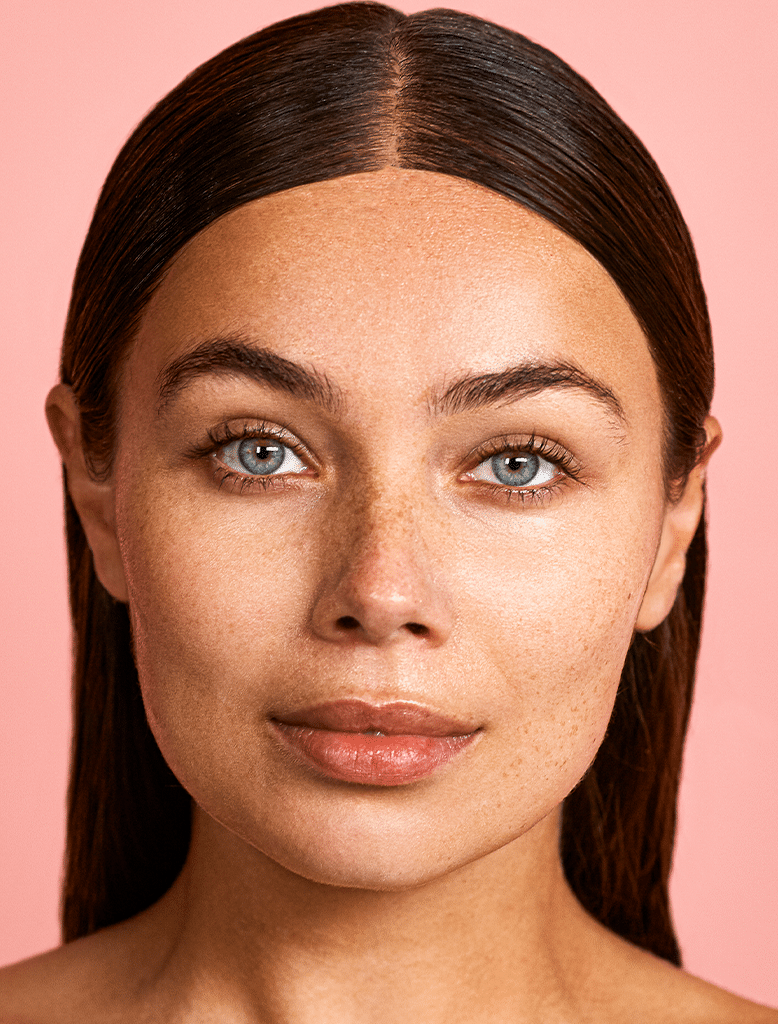 Your guide to melasma and how to treat it