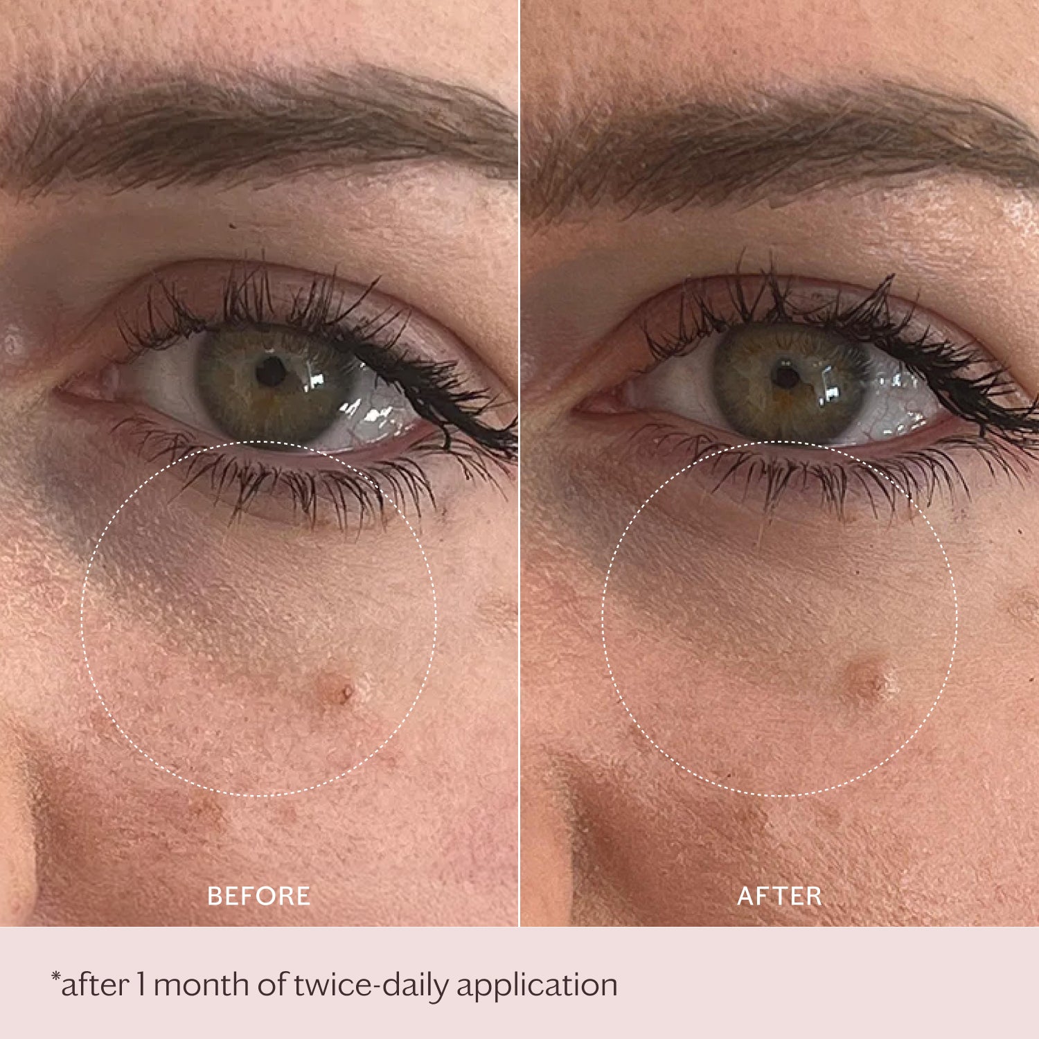 Intensive Bio-Placenta Eye Cream