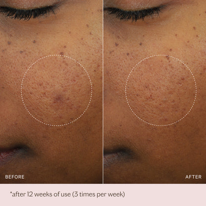 Micro-Peeling Glow Essence