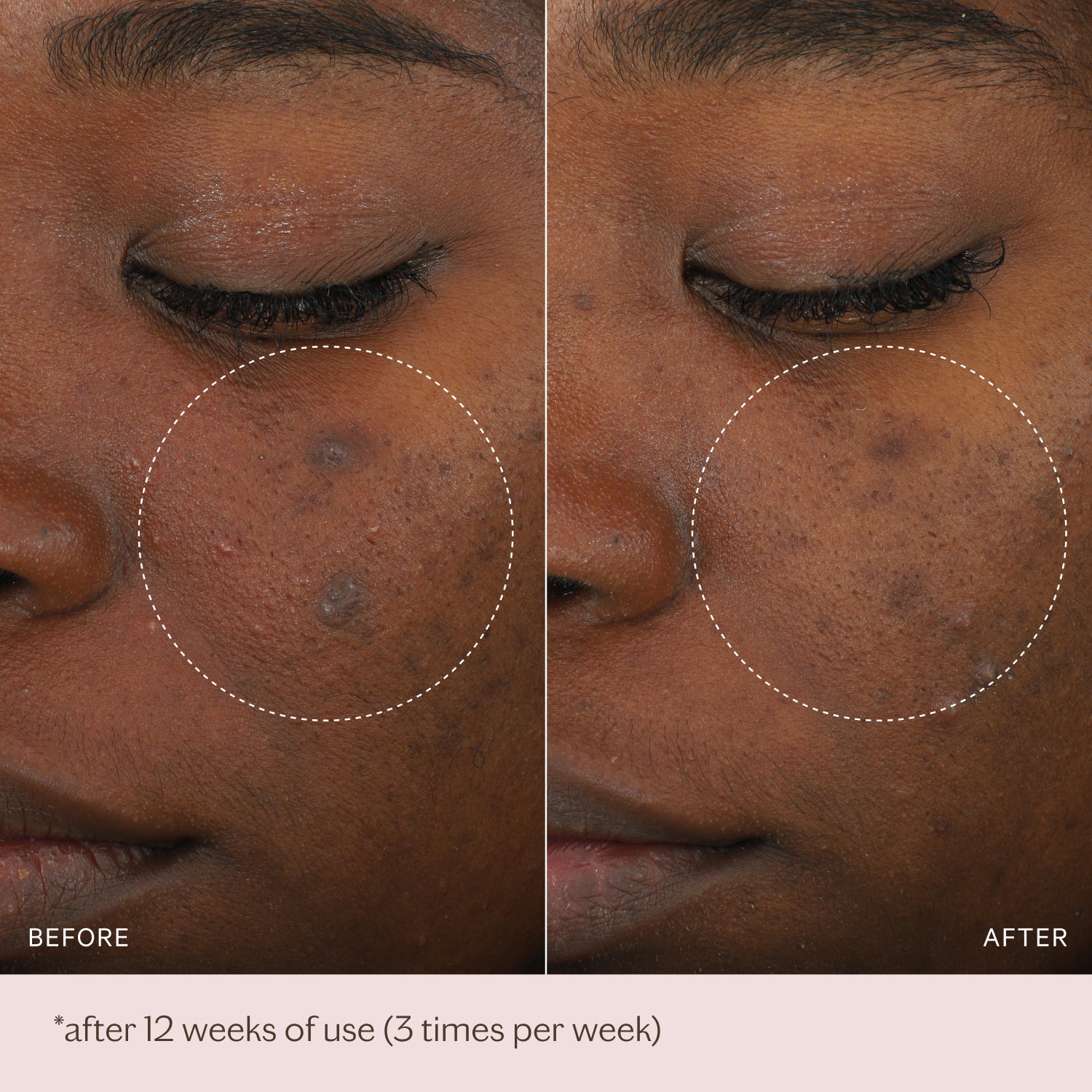 Micro-Peeling Glow Essence