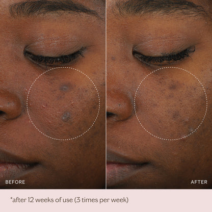 Micro-Peeling Glow Essence