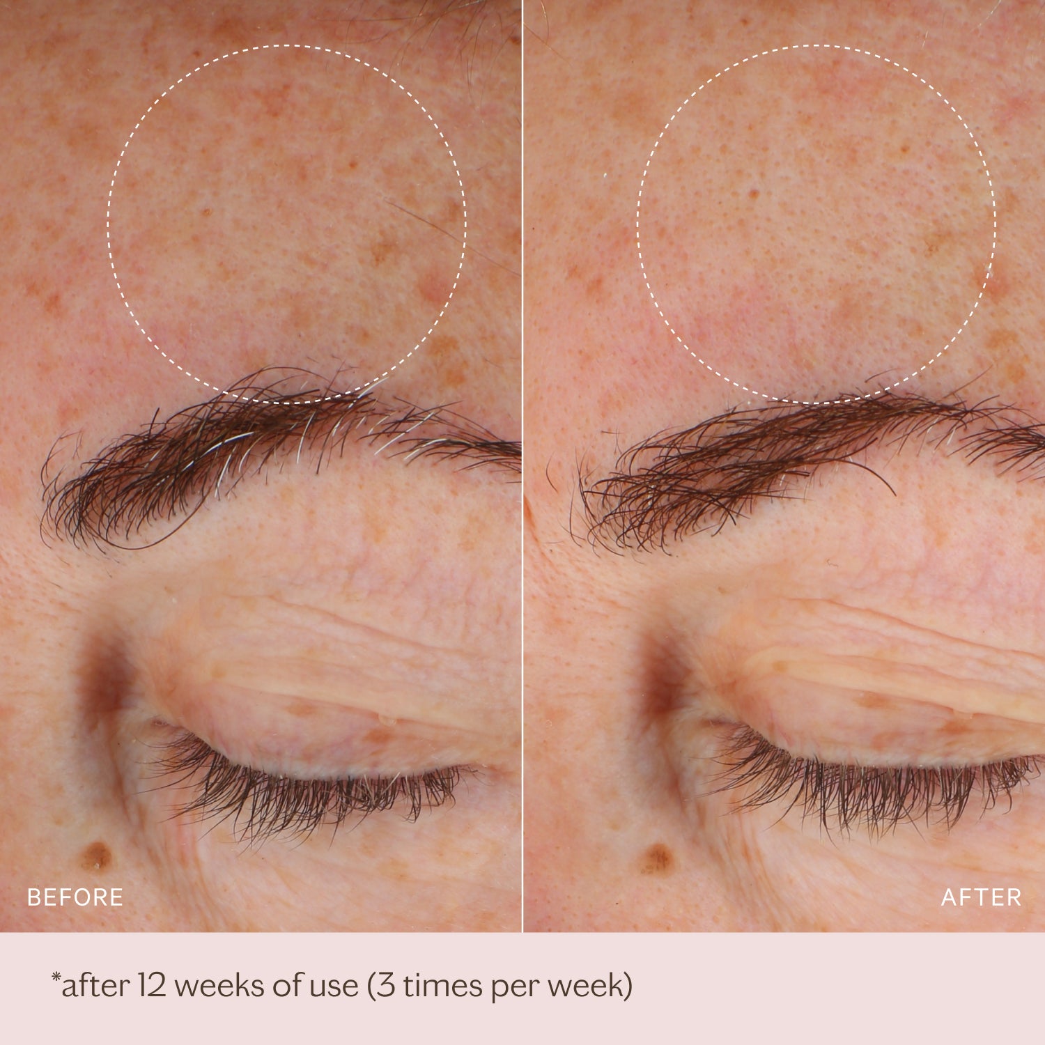 Micro-Peeling Glow Essence