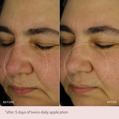 Hydra-Boost Ampoules