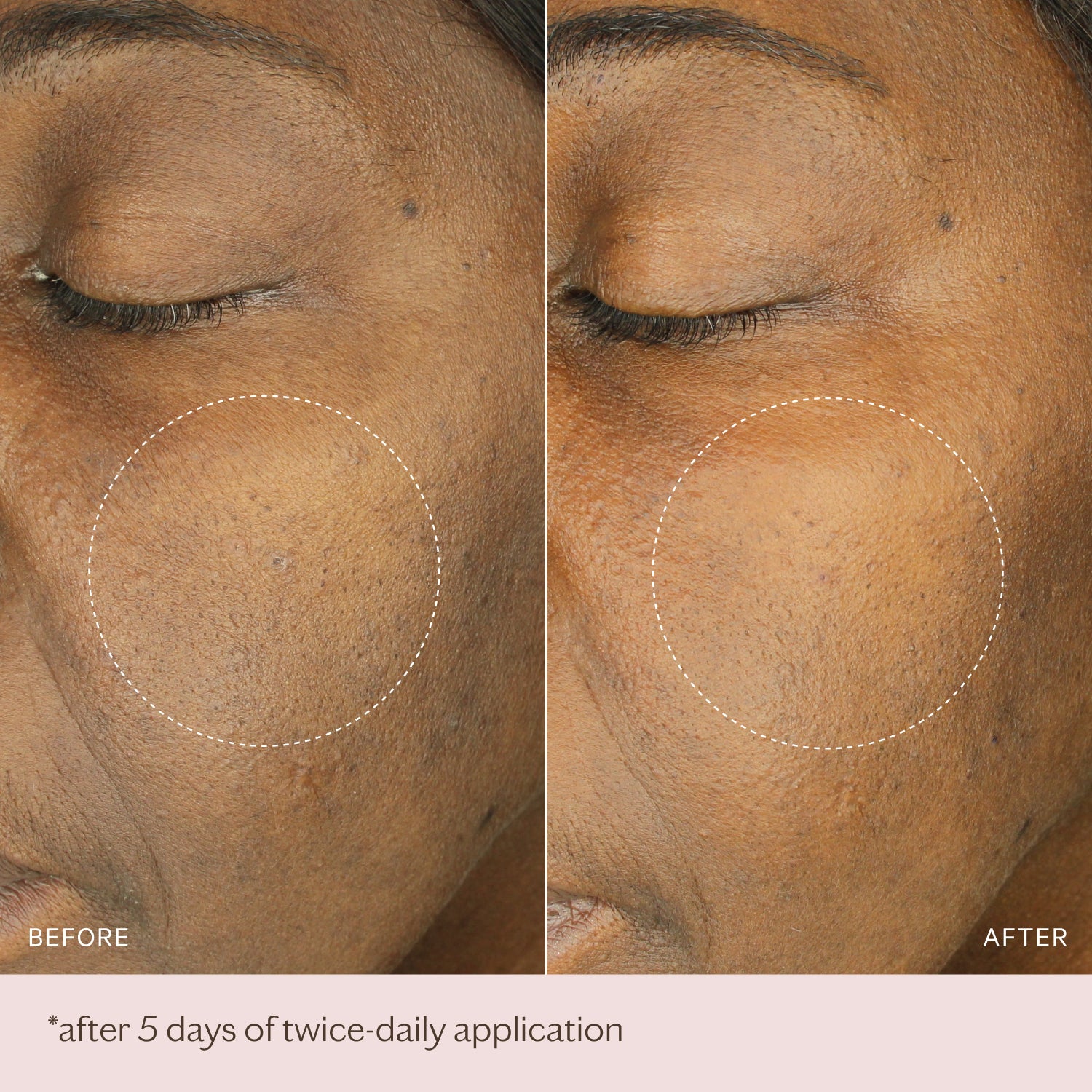 Hydra Boost Ampoules | MZ SKIN