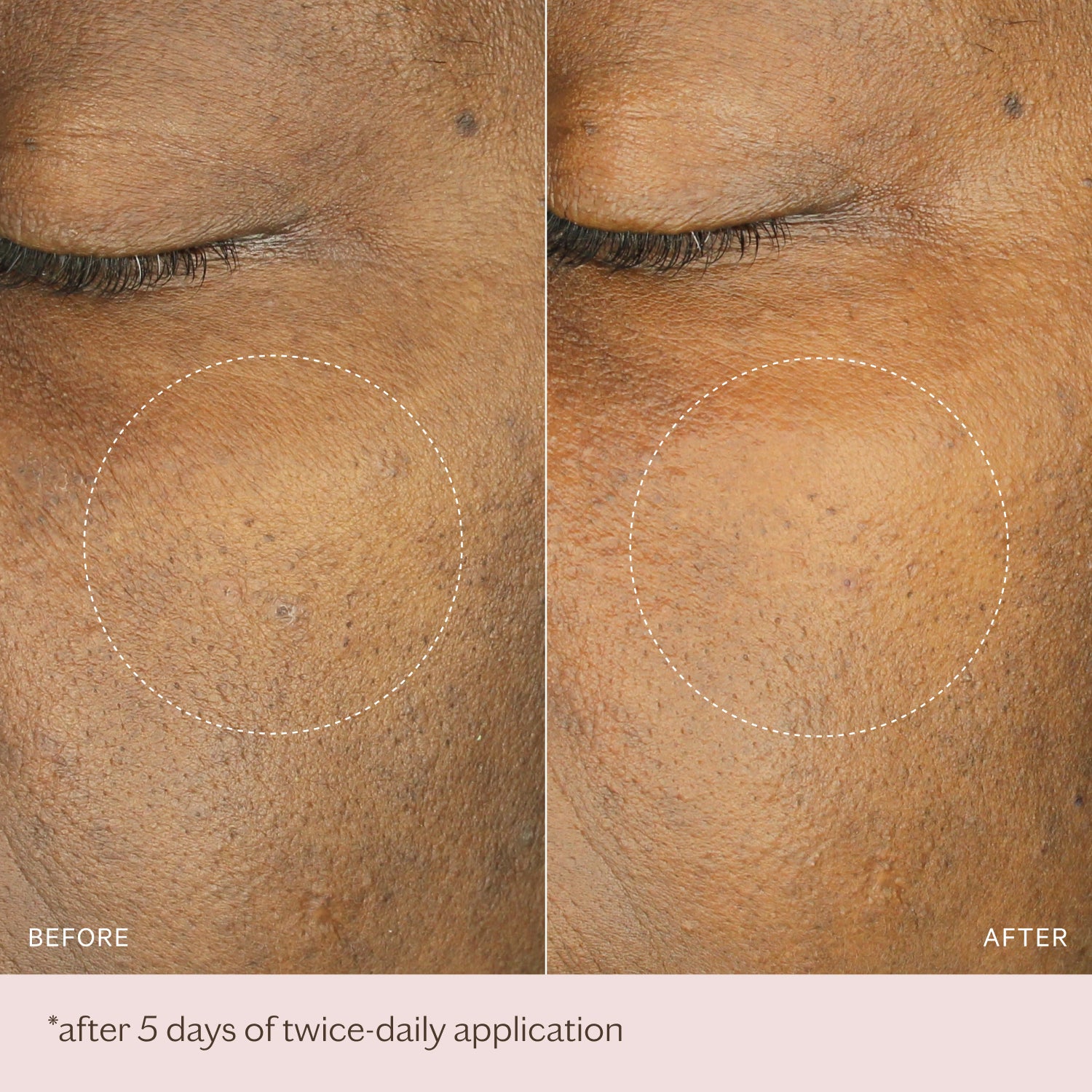 Hydra Boost Ampoules | MZ SKIN