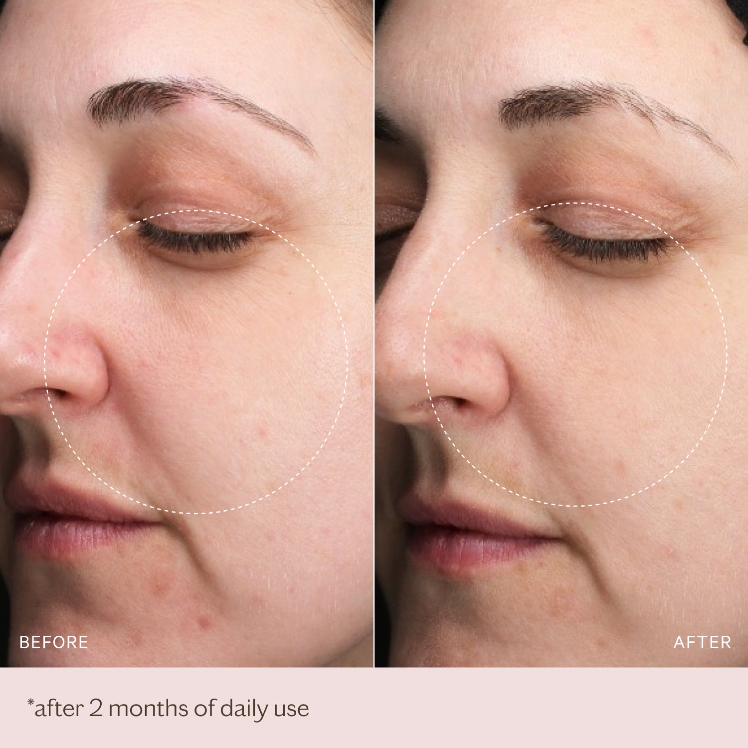 LED 2.0 Hydra-Glow Revival Set