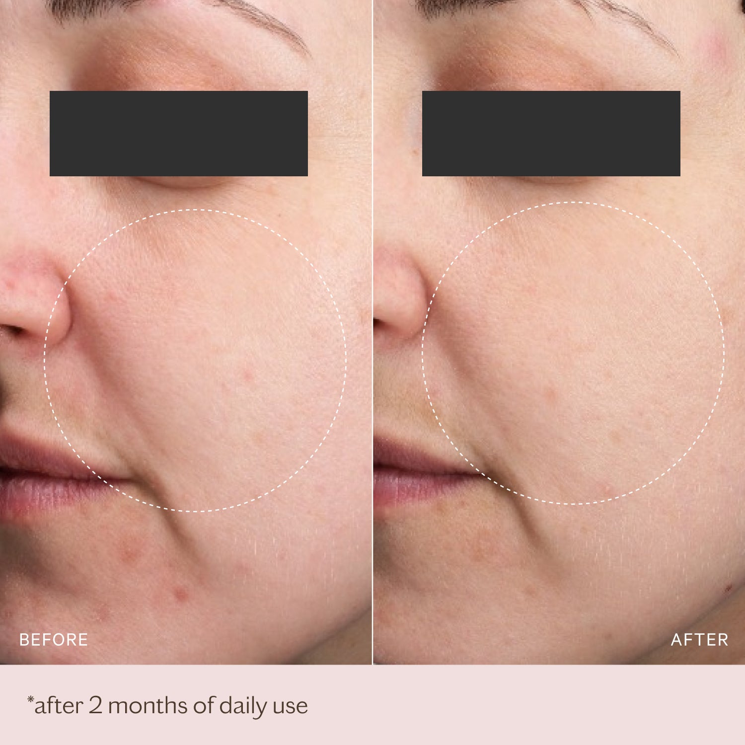 LED 2.0 Hydra-Glow Revival Set