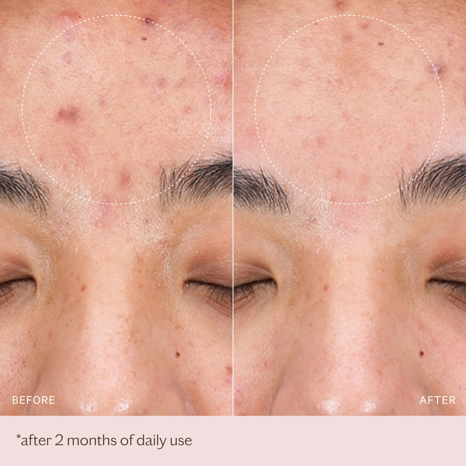 Radiance & Renewal Cleansing Mask | MZ SKIN