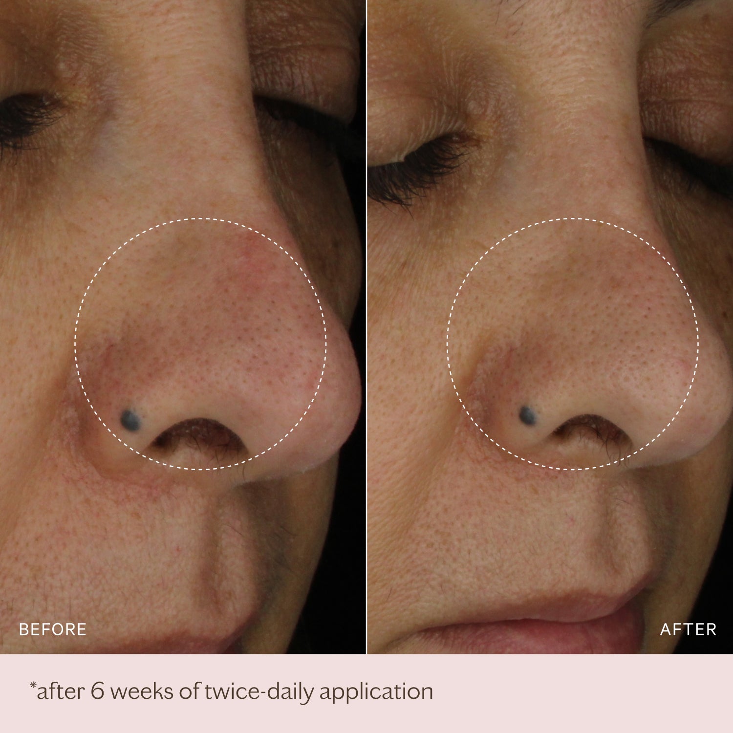 The Light Moisturiser