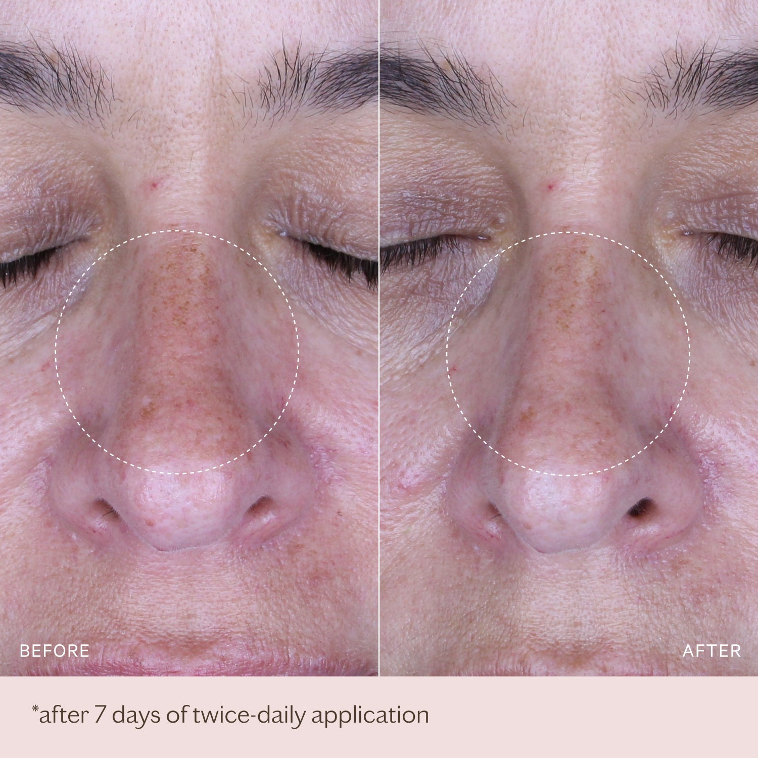 Pigmentation Correcting Ampoules