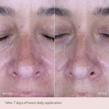 Pigmentation Correcting Ampoules