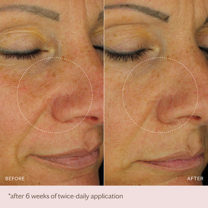 The Rich Moisturiser