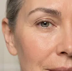Fine lines & Wrinkles